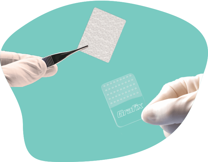 Landing Page GRAFIX PL Lyopreserved Placental Membrane and GRAFIX